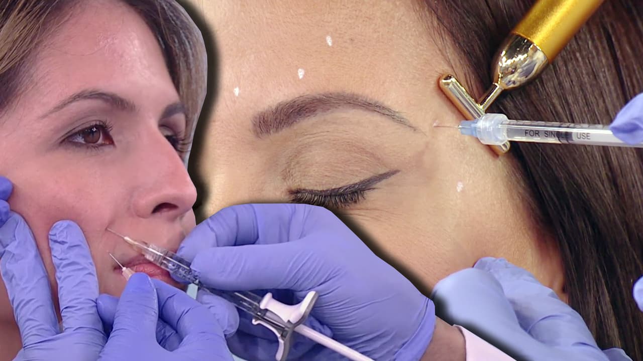 Novedosos tratamientos con inyecciones (en vez de bótox) para disminuir arrugas y restaurar el volumen de la piel