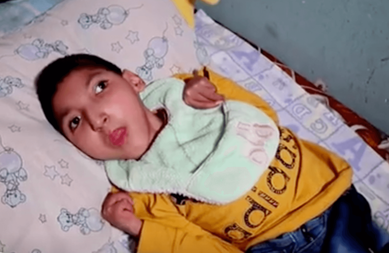 <b>Joven con hidrocefalia fue abandonado por sus padres</b>
<br>
<br>Edgardo es un muchacho en Monterrey, México, que ahora está bajo el cuidado de su abuela, pero a ella no le alcanza el dinero para todo lo que su nieto necesita.