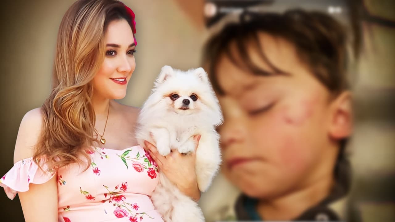 Al hijo de Sherlyn lo mordió su perrita en la cara y muestra las marcas que le dejó