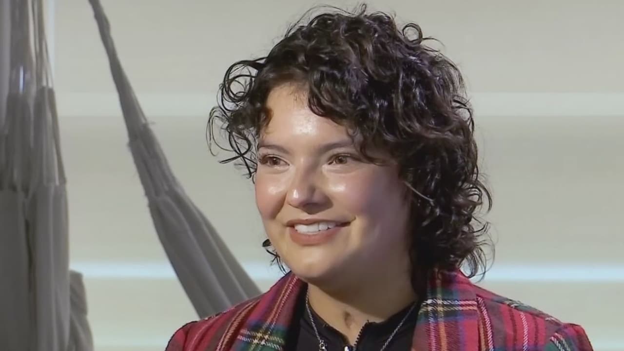 Bailarina hispana que terminó en llamas en un show cuenta su lucha para recuperarse: "Es un milagro"