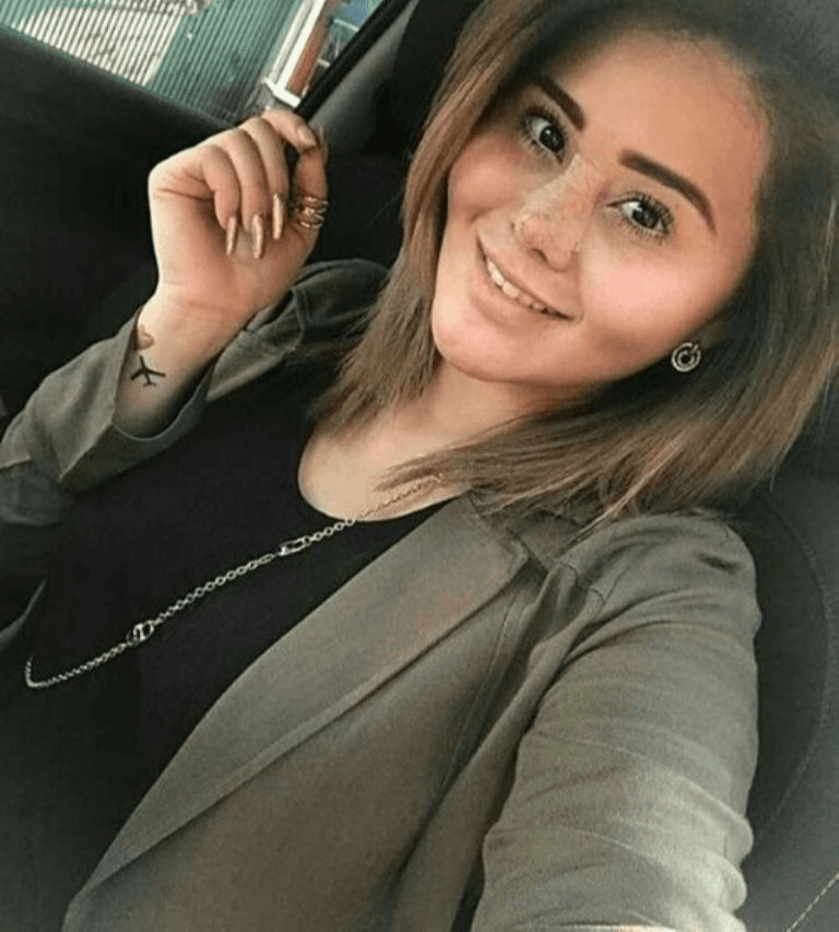 Gomita se realizó una rinoplastia.