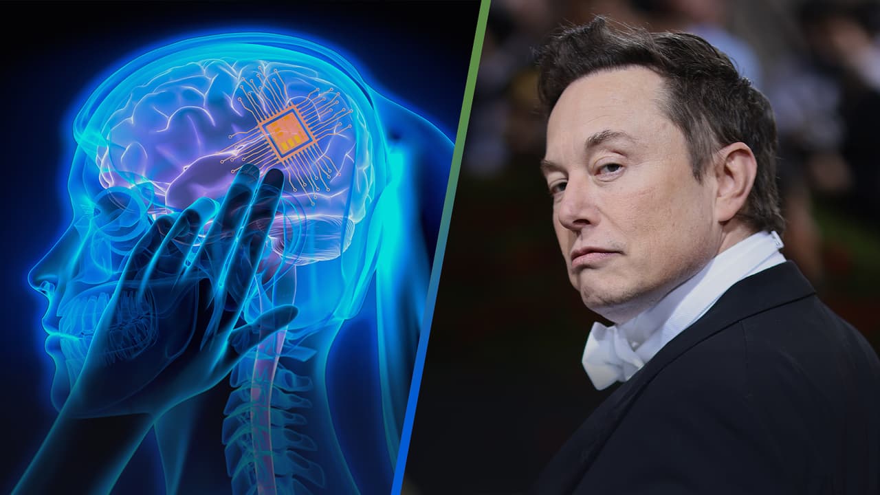 Elon Musk anticipa que en seis meses plantará por primera vez su Neuralink chip en un cerebro humano