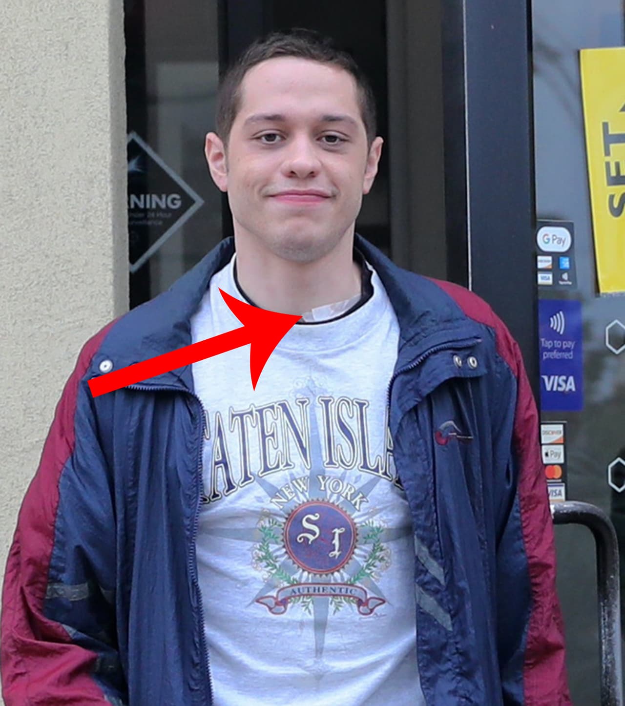 El actor fue captado en el set donde graba su nueva serie 'Bupkis' en Brooklyn, con la parte superior del cuello cubierto con un vendaje.