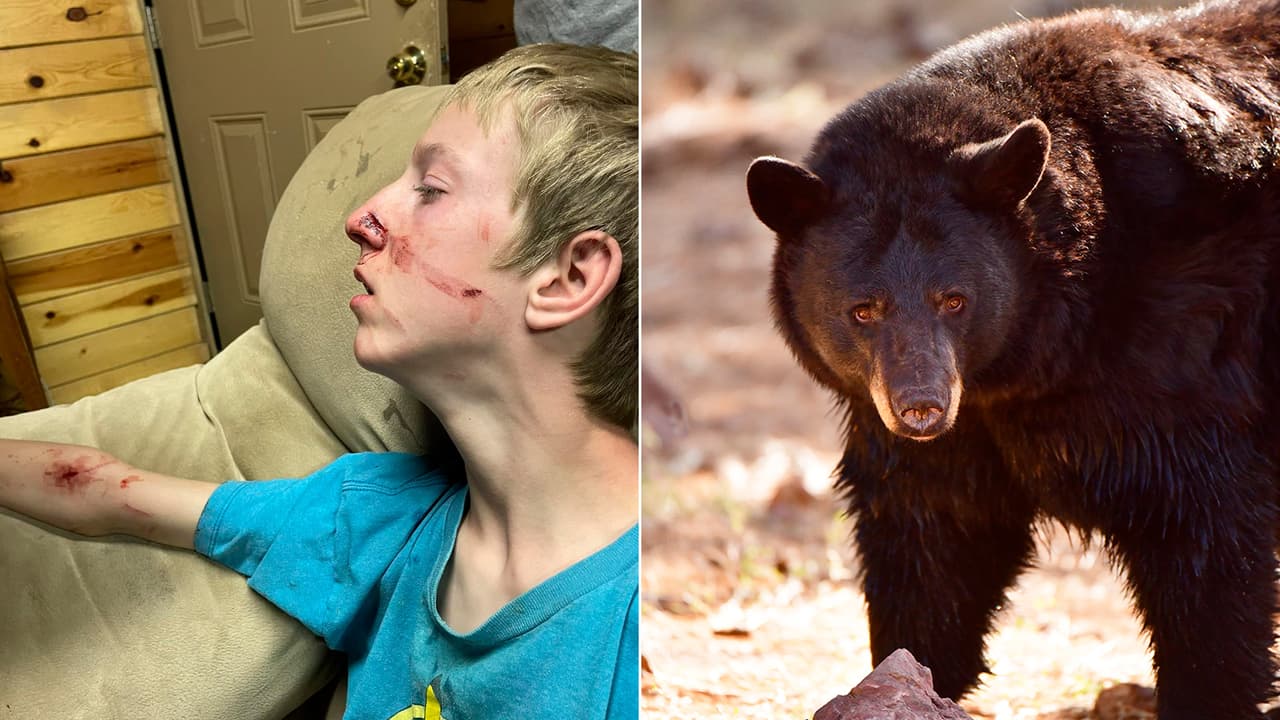 Adolescente se recupera tras el ataque de un oso negro en Arizona