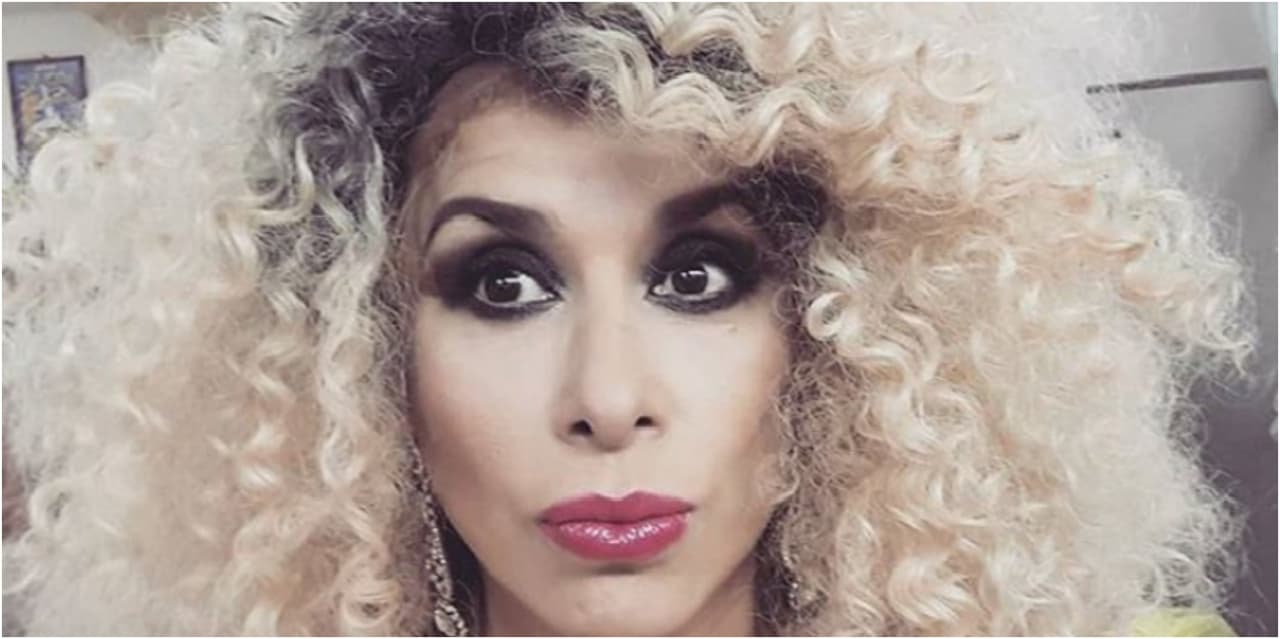 Esta es la extraña enfermedad que padece Dulce desde hace 15 años y que le provocó baja autoestima