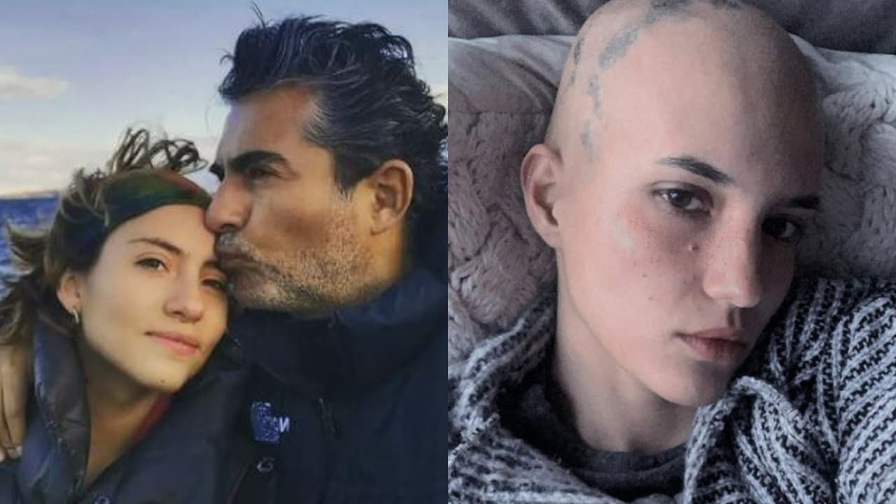 ¿Quién es la novia de Camila Araiza? La modelo luchó contra la alopecia y ahora agradece lo aprendido
