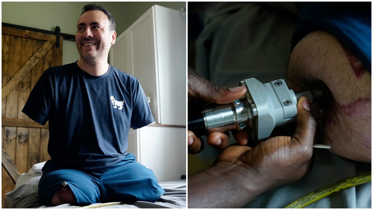 Padre de Nueva Jersey perdió brazos y piernas tras gripe y quiere volver a caminar con cirugía inédita