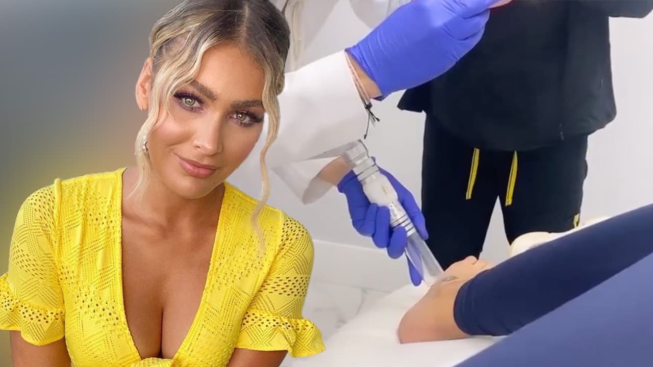 Migbelis Castellanos 'sufre' en la segunda sesión para eliminar su tatuaje "expirado"