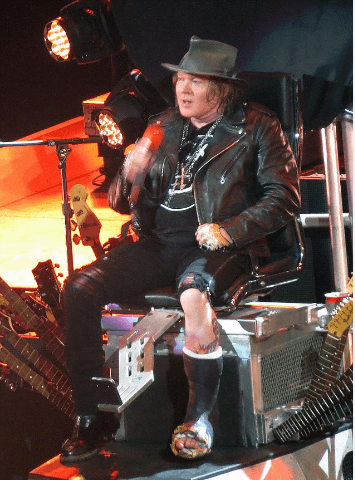 ¡Hoy se ve así! El cantante ha engordado muchísimo de un tiempo para acá y justo en el arranque de las pocas fechas que darán, él se rompió un dedo del pie, por lo que tuvo que salir a escena con un yeso (negro muy rocker) y estuvo en una silla de ruedas ... de "metal".