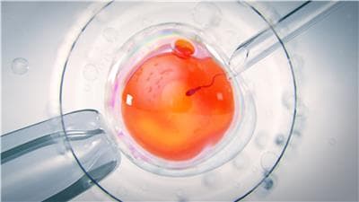 Tiene un gen que puede producir cáncer y donó su semen para procrear cerca de 200 niños en 14 países: algunos ya murieron