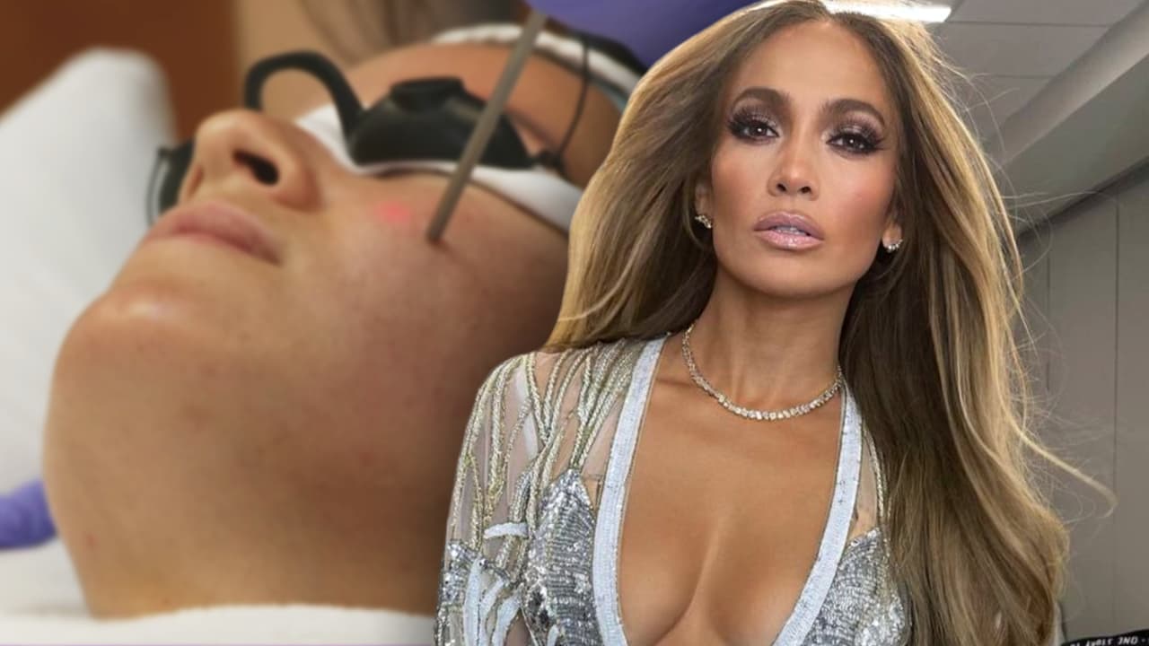 Descubre la tecnología para lucir una piel de porcelana igual a la de Jennifer López y otras famosas