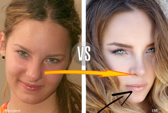 La nariz, los pómulos, los labios... ¿Le creemos que todo sea natural? El sitio Zócalo informó que la cantante lleva más de 15 cirugías.