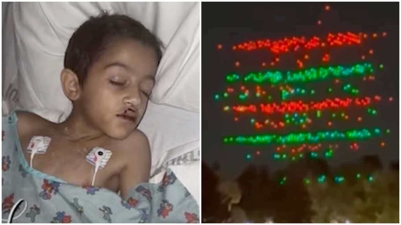 "Hay una huella en su pecho": El niño de 7 años herido por un dron es operado a corazón abierto en Orlando 