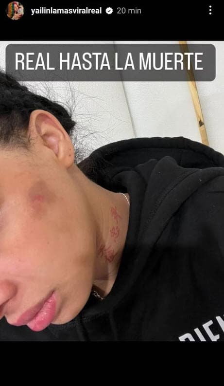 La estocada la dio 
<b><a href="https://www.univision.com/famosos/tekashi-revela-anuel-golpeo-yailin-embarazada-evidencia-foto" target="_blank">Yailin acusando a su ex de supuestamente haberla golpeado</a> </b>mientras estuvo embarazada de su hija.