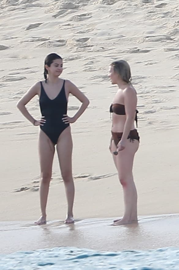 La artista dejó ver la gigante cicatriz que tiene en su muslo derecho.