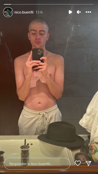 'Nico', como lo llama de cariño la actriz de 'Vencer el pasado', compartió una historia en Instagram en la que aparecé con la cabeza rapada.
