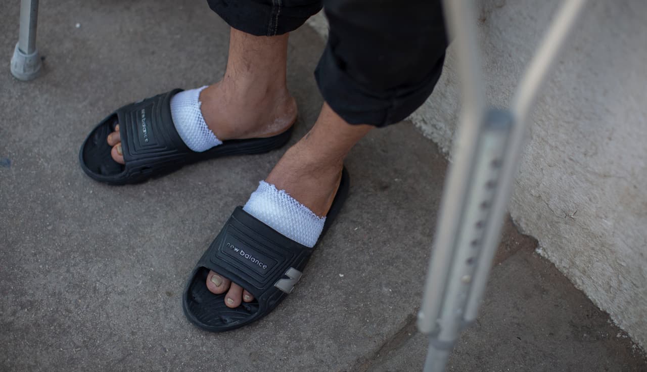 Pastrana asegura que tras su rescate en el desierto no encontró alivio. Asegura que no recibió atención médica sino hasta que llegó al hospital general de Nogales, en México, donde ahora se recupera usando unas muletas y tomando antibióticos.