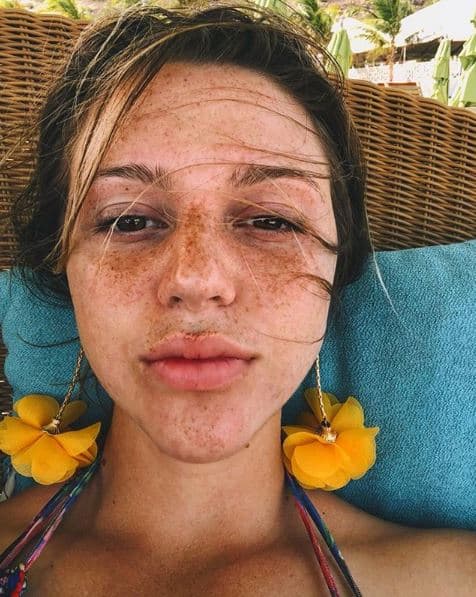 Madison Anderson Berríos nació el 10 de noviembre de 1995 en la ciudad de Phoenix en Arizona y se crió en Orlando, Florida.