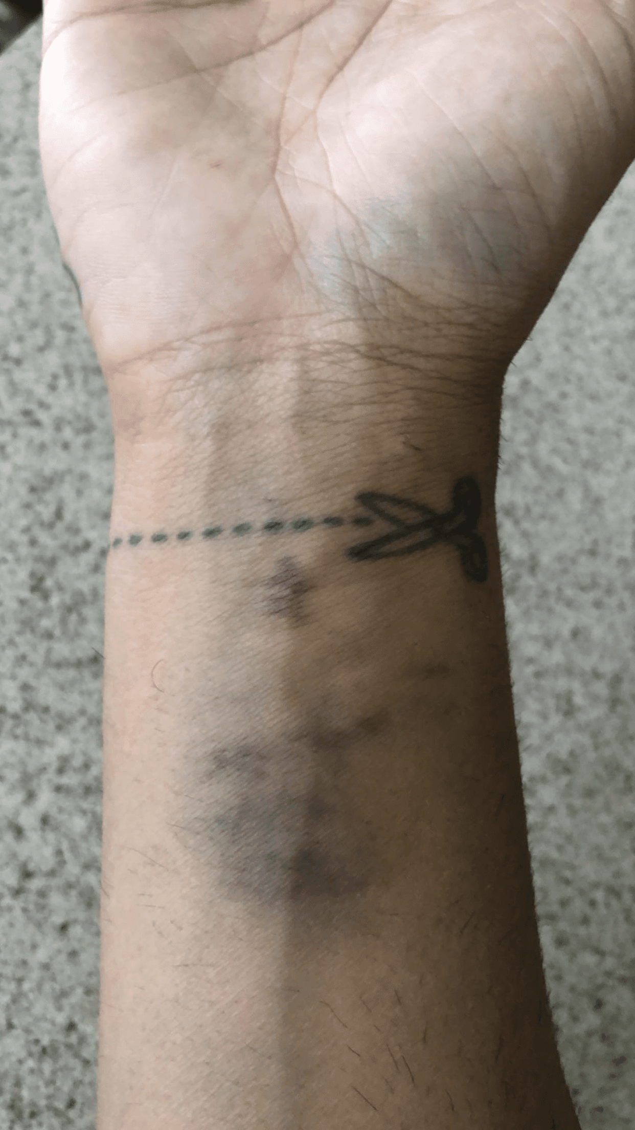 Este19 de septiembre publicó una foto de la que podría ser su muñeca con varios hematomas.