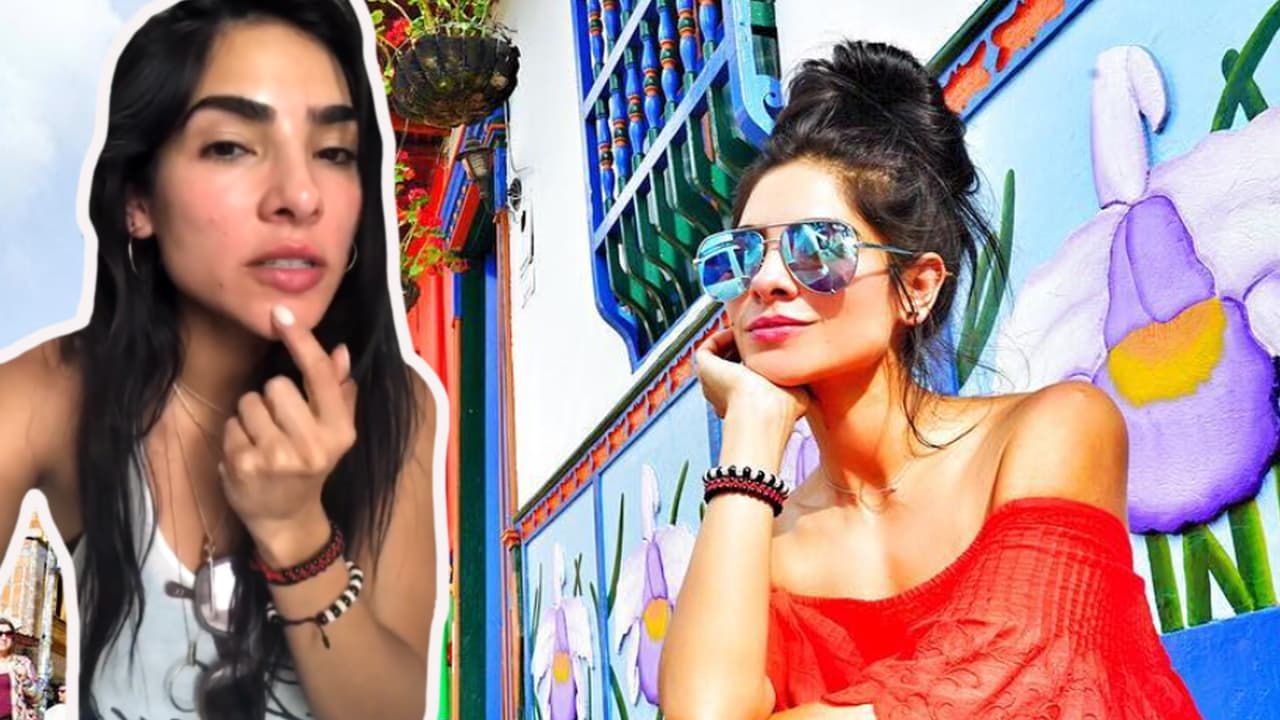 Se muestra al natural: Alejandra Espinoza enseña (sin temor) las imperfecciones de su rostro