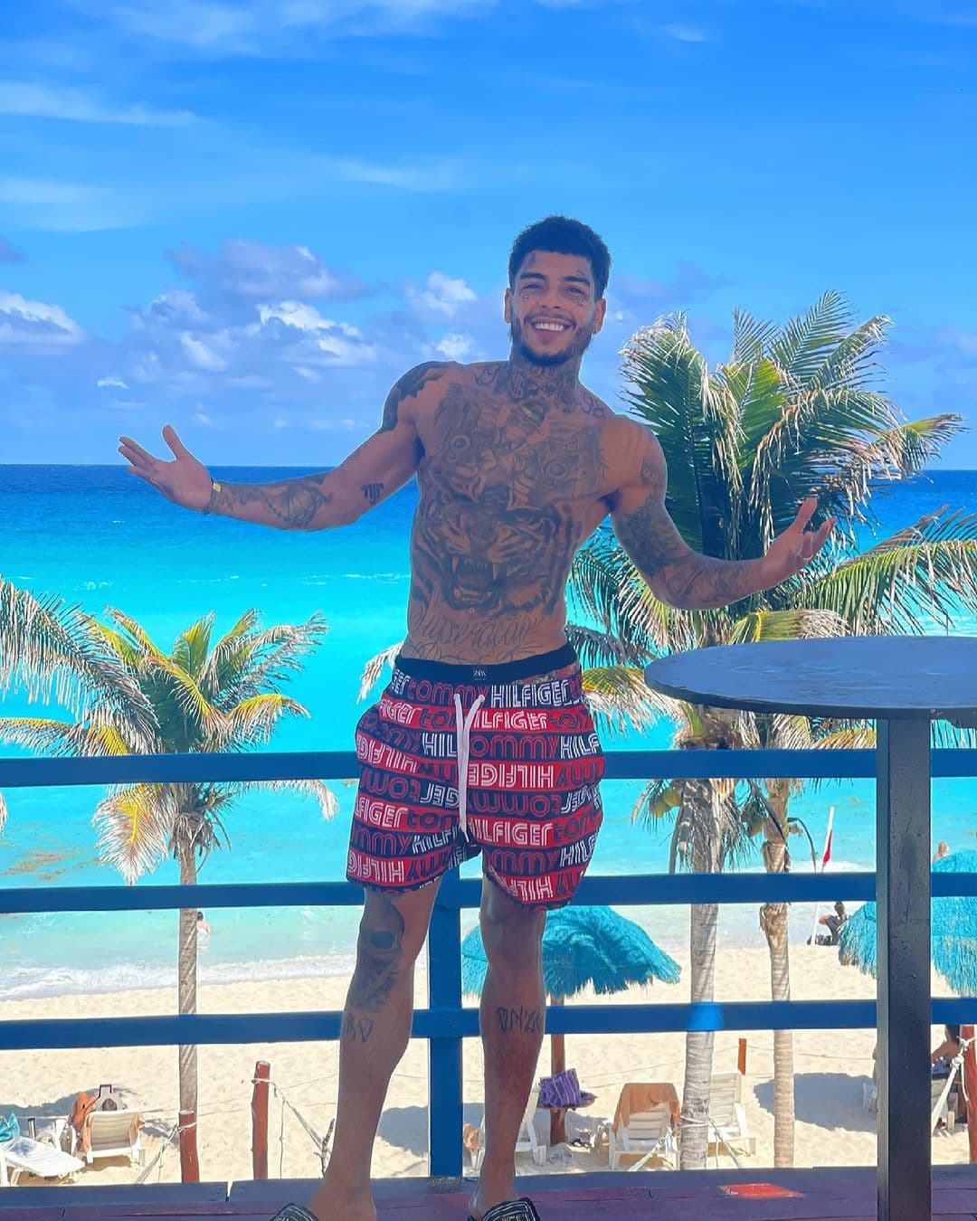 Tuvo fracturas en la nariz, mandíbula y 10 costillas del lado izquierdo.
<br>