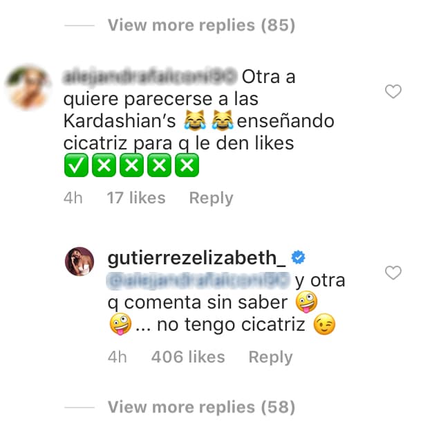 Incluso la acusaron de querer copiar a Kylie Jenner, quien solía publicar imágenes donde lucía la cicatriz que tiene en la pierna.