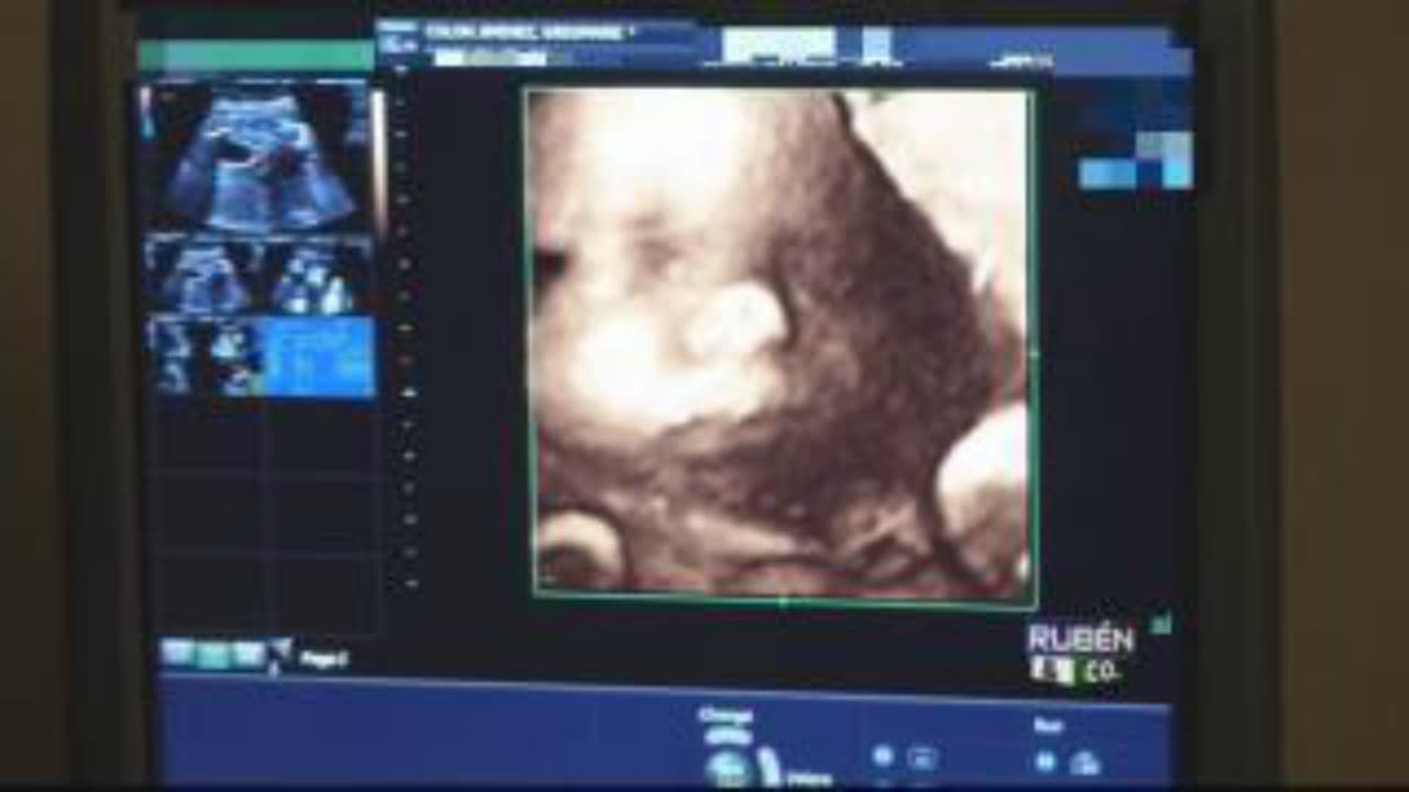 Así se vio baby Kamilia en la barriguita de su mami.