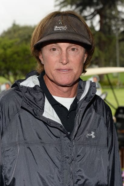 Todo comenzó con unos cuantos arreglitos en la cara.