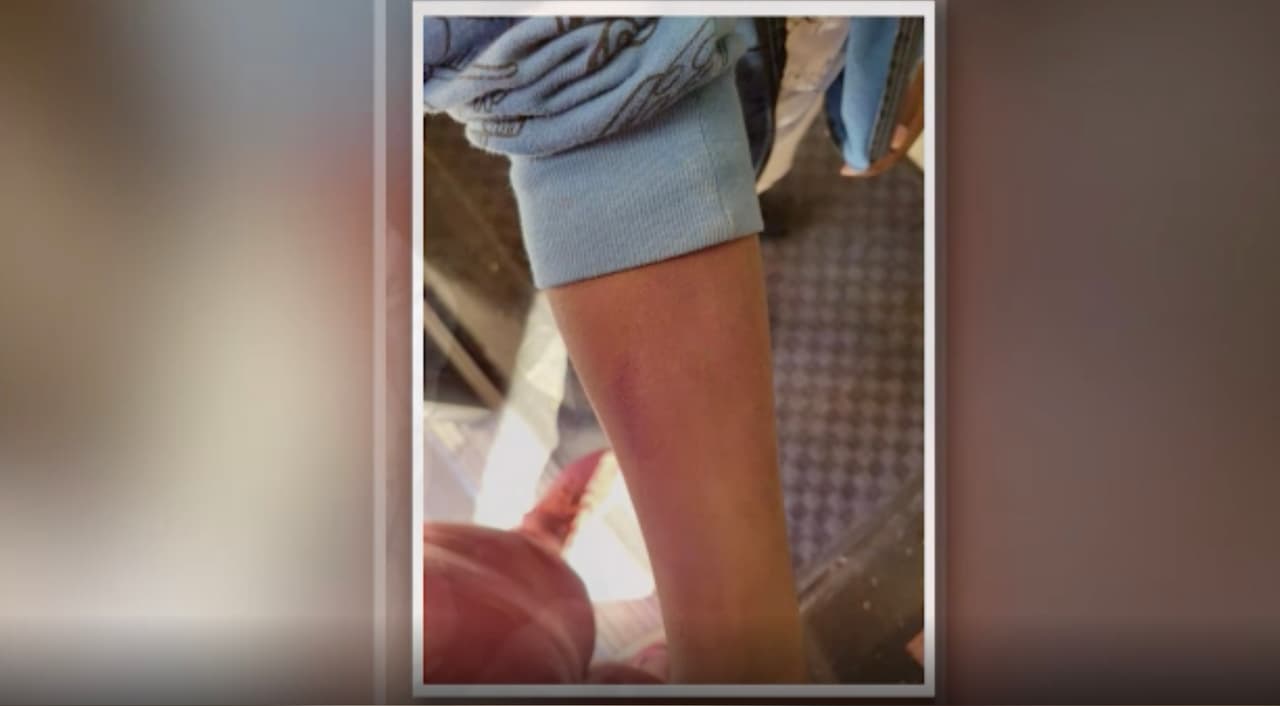 <b>“Parece que la escuela está encubriendo a la maestra y eso está mal”,</b> dijo Jaime Collier, madre de la estudiante, quien pide su destitución y ser acusada por agresión a un menor tras hacer la denuncia en la 
<b><a href="https://www.univision.com/local/houston-kxln/gloria-williams-vivio-con-cadaver-de-kendrick-lee-y-luego-abandono-hijos-dia-de-accion-de-gracias">policía de Houston</a>.</b>