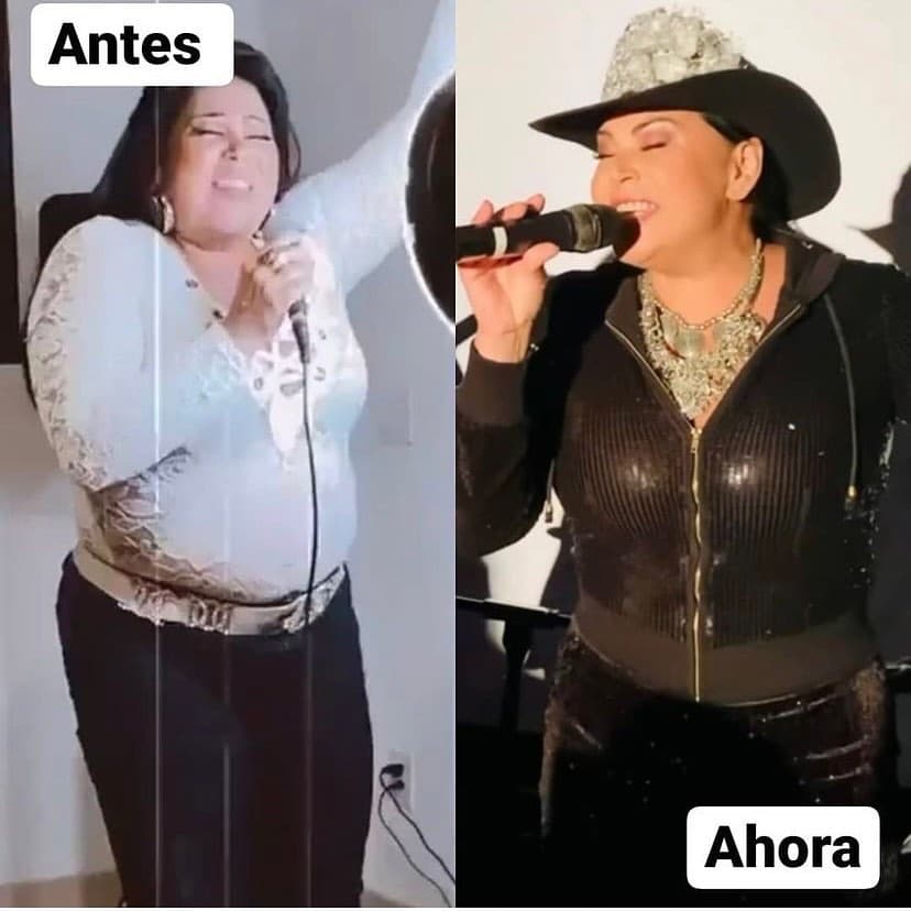 Ante esto, en abril de 2021 tomó la decisión de someterse a la banda gástrica. 
<br>