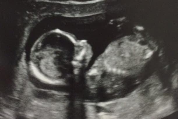 Alejandra no aguanta la emoción de celebrar la primera navidad de su hijo Matteo de casi 9 meses. Mira las fotos más cute de Matteo, un bebé tan stylish como su mamá.