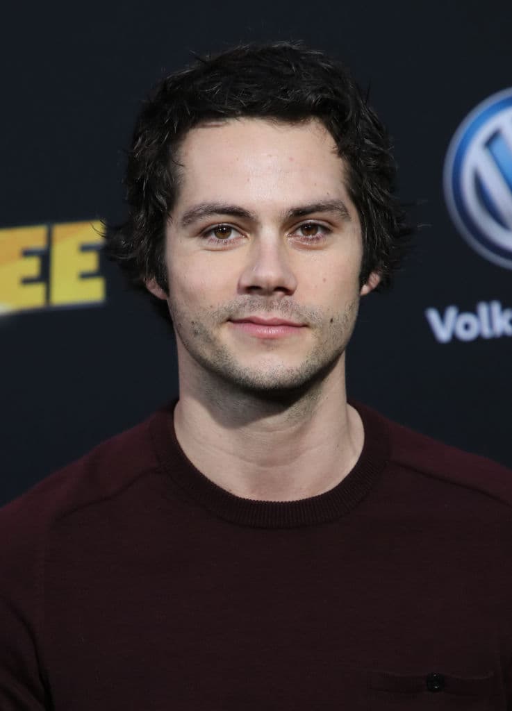 Dylan O'Brien en Maze Runner: The Death Cure (2018)
<br>Dylan sufrió uno de los accidentes más Fuertes, el actor cayó de un vehículo en movimiento y fue golpeado por otro vehículo que lo seguía, O’Brien sufrió una conmoción, fracturas y desgarres en la cara que le provocaron un trauma psicológico.