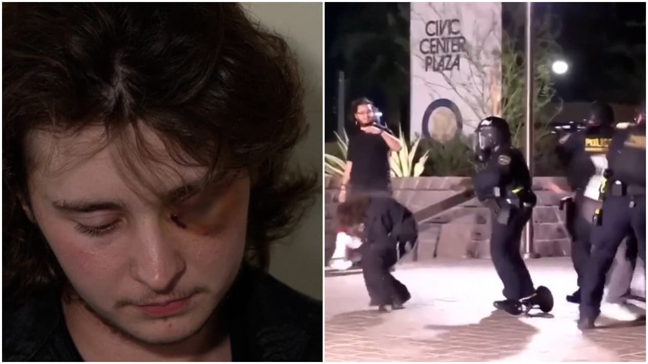 Quedó ciego de un ojo y ahora cuenta lo que pasó en una protesta en California