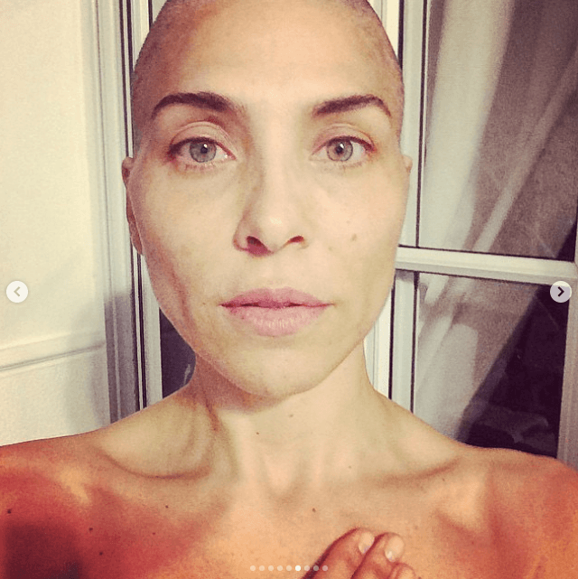 Su travesía con esta enfermedad quedo plasmada en un libro titulado ‘Sobreviviente’. Así como en fotografías que ha compartido en redes sociales, varias de ellas con su cabeza sin pelo.