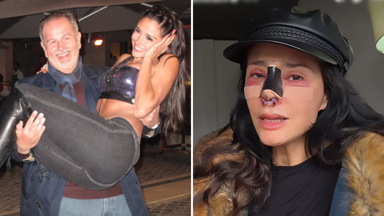 Excolaboradora de El Gordo y La Flaca sufre amputación: Dorismar vive pesadilla tras cirugía