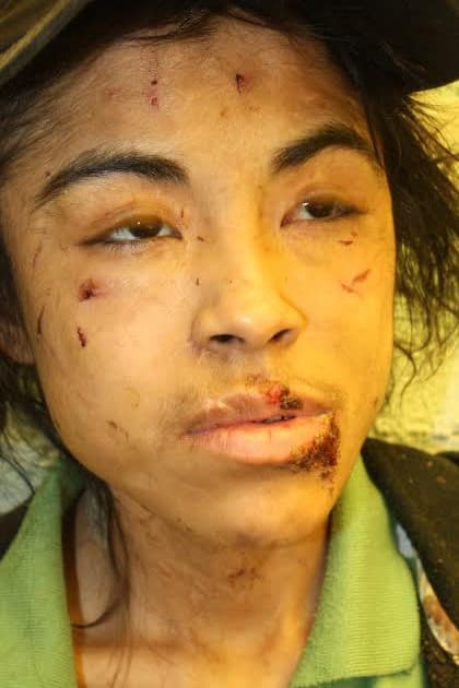 Los dos últimos años de su encierro, Zúnduri llevó cadenas en el cuello y la cintura. Cuando escapó, tenía 600 cicatrices en el cuerpo causadas por los repetidos golpes y quemaduras.