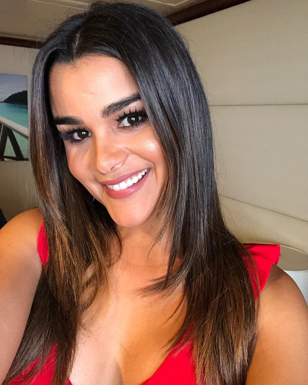 La vez que
<a href="https://www.univision.com/shows/el-gordo-y-la-flaca/clarissa-molina-sufre-un-accidente-al-quemarse-con-una-plancha-y-sin-censura-muestra-su-muy-rojiza-herida-video">se quemó con una plancha</a>, mostró la herida y sus mismos seguidores fueron quienes le dieron la solución para la fuerte picazón.