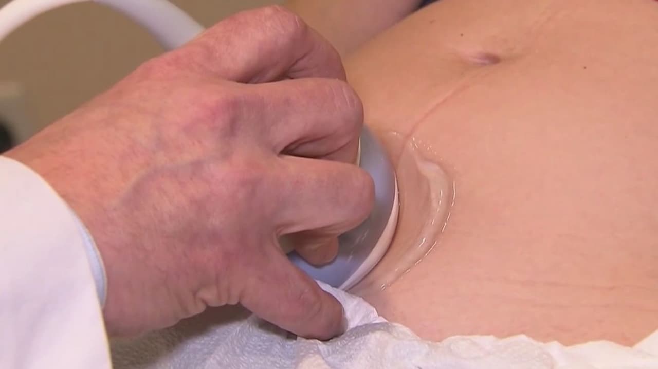 ¿Por qué bajó el consumo de acetaminofén en embarazadas? Doctor habla sobre dudas del fármaco