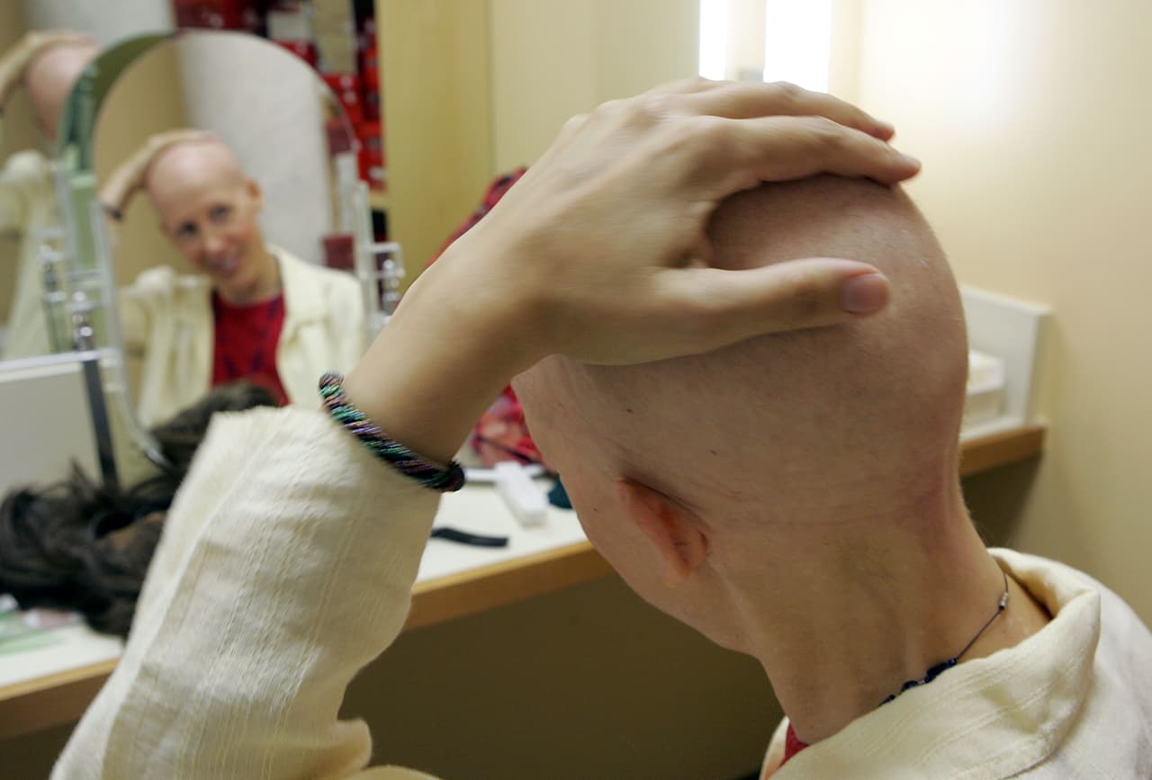 SAN FRANCISCO - AUGUST 17: Breast cancer patient Susanne Ostlund rubs her head before trying on a wig at the Friend to Friend store at the UCSF Comprehensive Cancer Center August 17, 2005 in San Francisco, California. The UCSF Comprehensive Cancer Center continues to use the latest research and technology to battle cancer and was recently rated 16th best cancer center in the nation by US News and World Report. (Photo by Justin Sullivan/Getty Images)