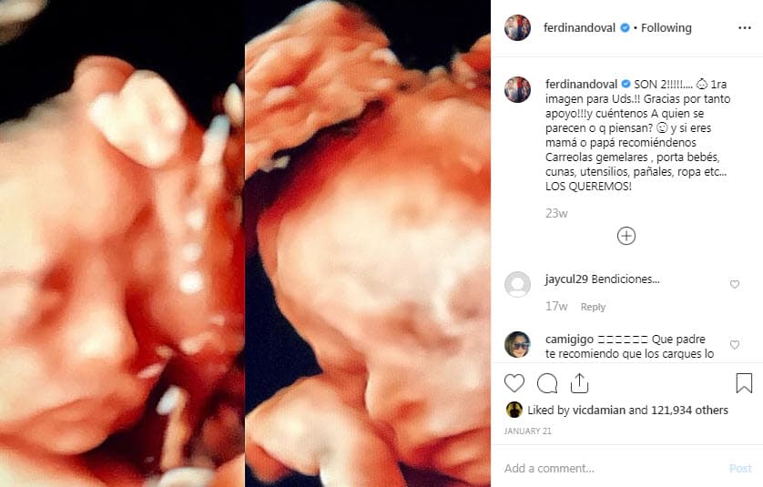 El protagonista de 'Simplemente María' compartió la noticia en sus redes sociales y publicó la primera imagen de los mellizos.