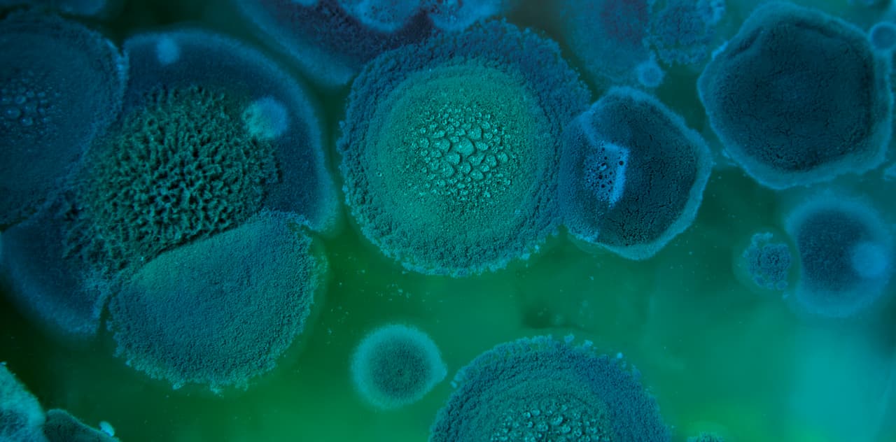 ¿Un archipiélago de islas en un mar verde esmeralda? No. Estas son colonias del hongo
<i>Aspergillus fumigatus</i>.