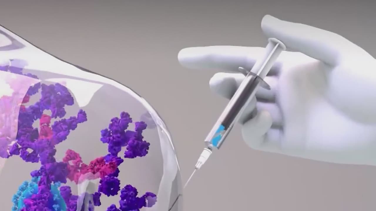 ¿Por qué hay efectos secundarios después de una segunda dosis de la vacuna Covid-19?