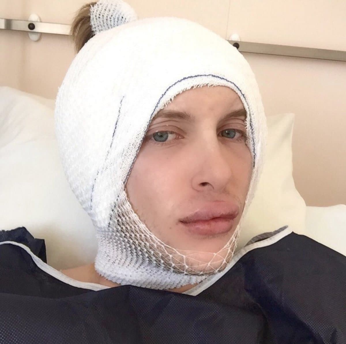 Les presentamos a Anastasia Reskoss y Quentin Dehar. Ellos son una pareja de origen francés que ha gastado aproximadamente 300 mil dólares en cirugías plásticas para parecerse a los muñecos Barbie y Ken. Será que se parecen ?