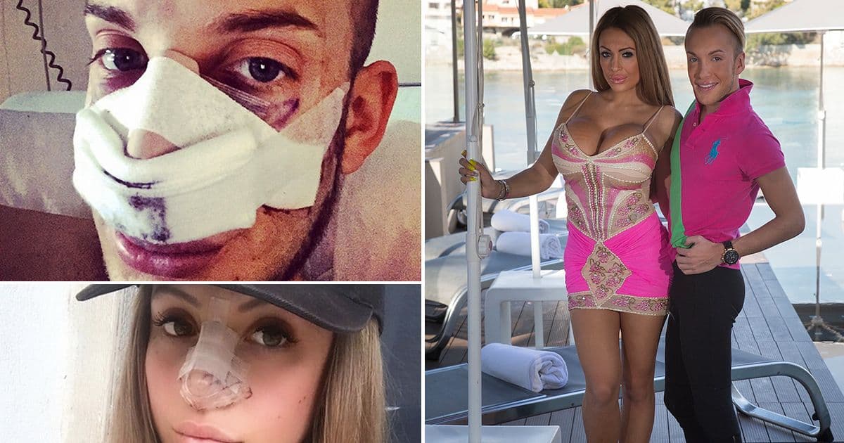 Les presentamos a Anastasia Reskoss y Quentin Dehar. Ellos son una pareja de origen francés que ha gastado aproximadamente 300 mil dólares en cirugías plásticas para parecerse a los muñecos Barbie y Ken. Será que se parecen ?