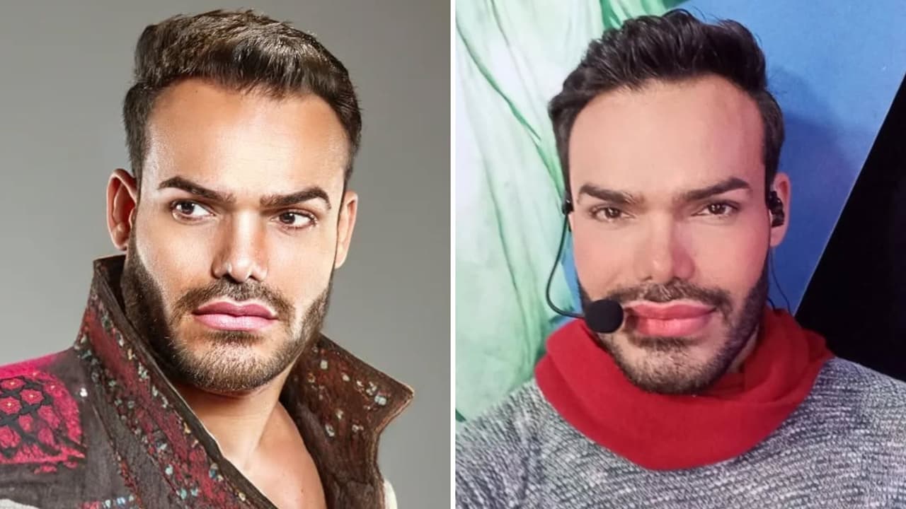 Muere presentador ‘Emilio Sueños’ tras una semana hospitalizado: “Empezó a toser y a no poder respirar”