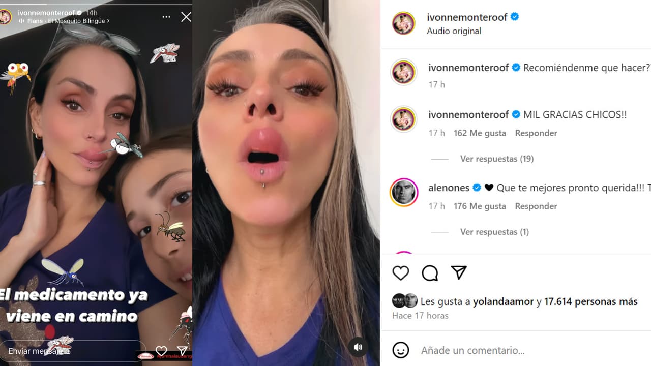 La actriz recurrió a un medicamento para controlar la severa inflamación que sufrió.