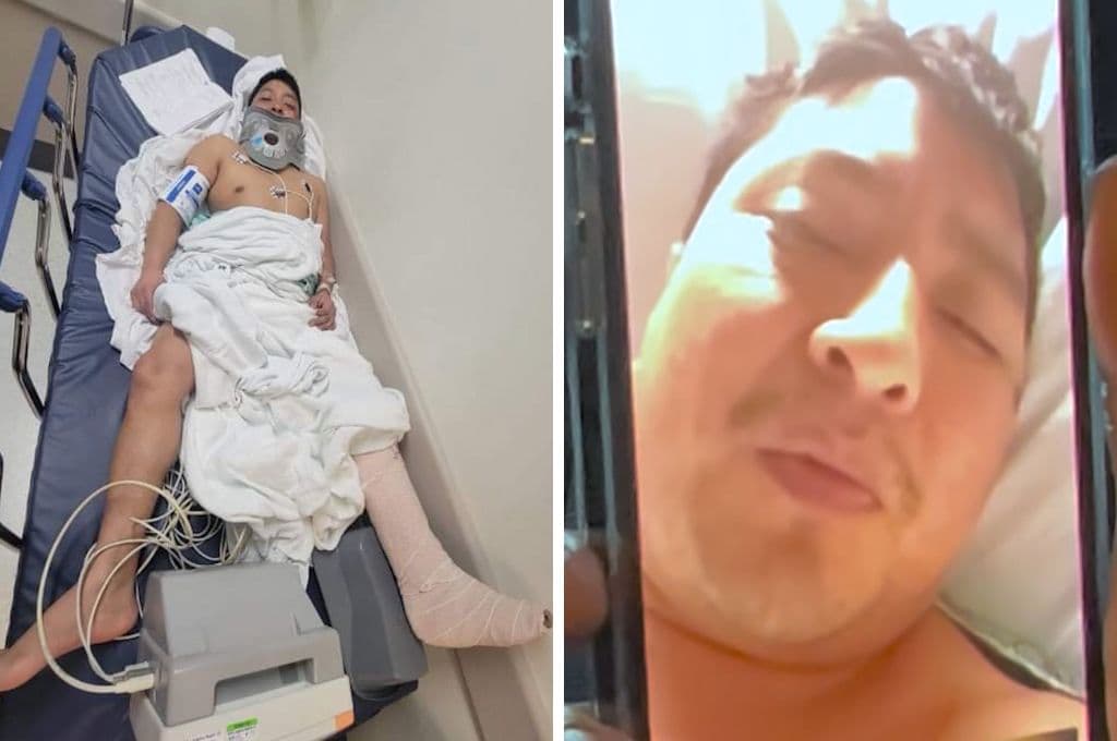 "Pasarán meses para volver a caminar": Ever Coy habla sobre accidente que le cambió la vida