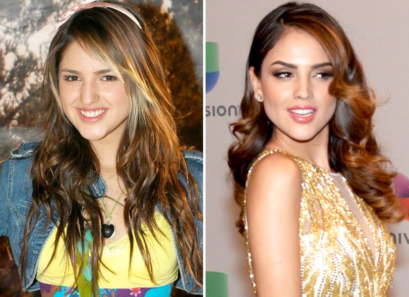 Tras rumores de que se había sometido a varias cirugías estéticas en 2011, Eiza González admitió a través de su cuenta de Twitter que solo se había intervenido la nariz.