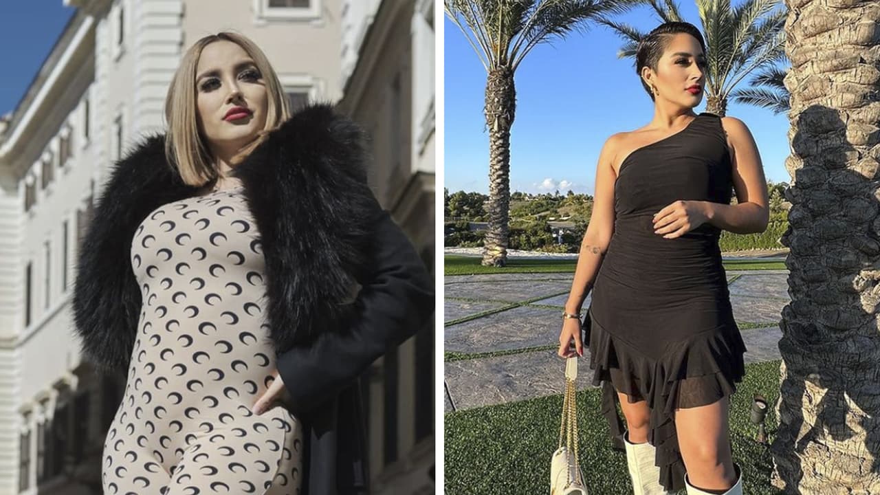 Daisy Anahy revela las cirugías que se hizo: "Ya saben, necesitaba una correción"