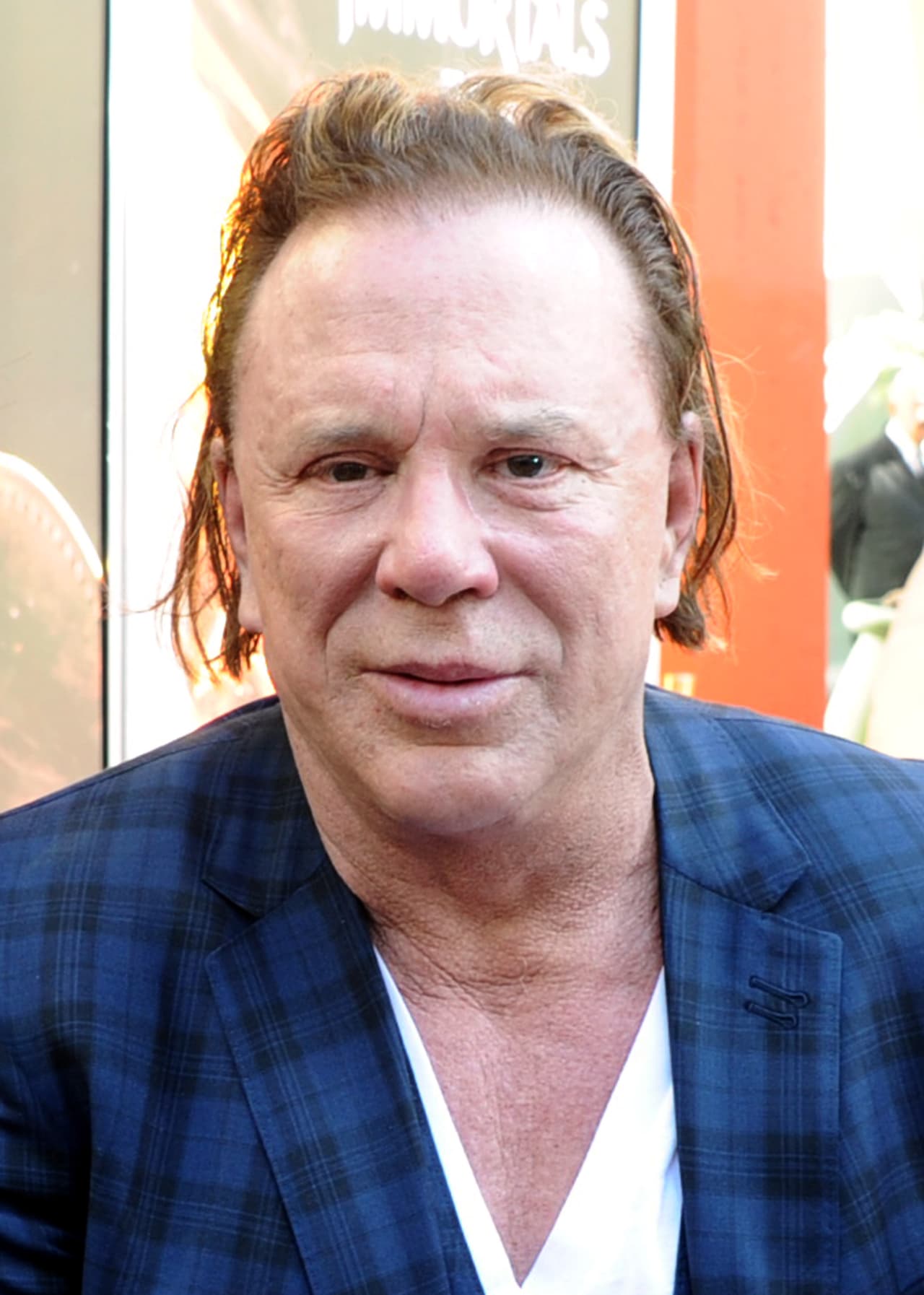 Para intentar enmendar los efectos de los golpes en su cara, Mickey recurrió a la cirugía plástica. No obstante, el resultado no fue el esperado.